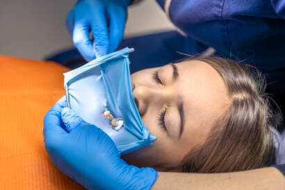 The dentist treats the child's tooth using a rubber dam. Close-up of tooth treatment.