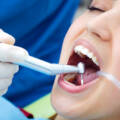 AirPolish Advanced Dental Cleaning Service in Gurgaon – A Modern Approach to Oral Hygiene