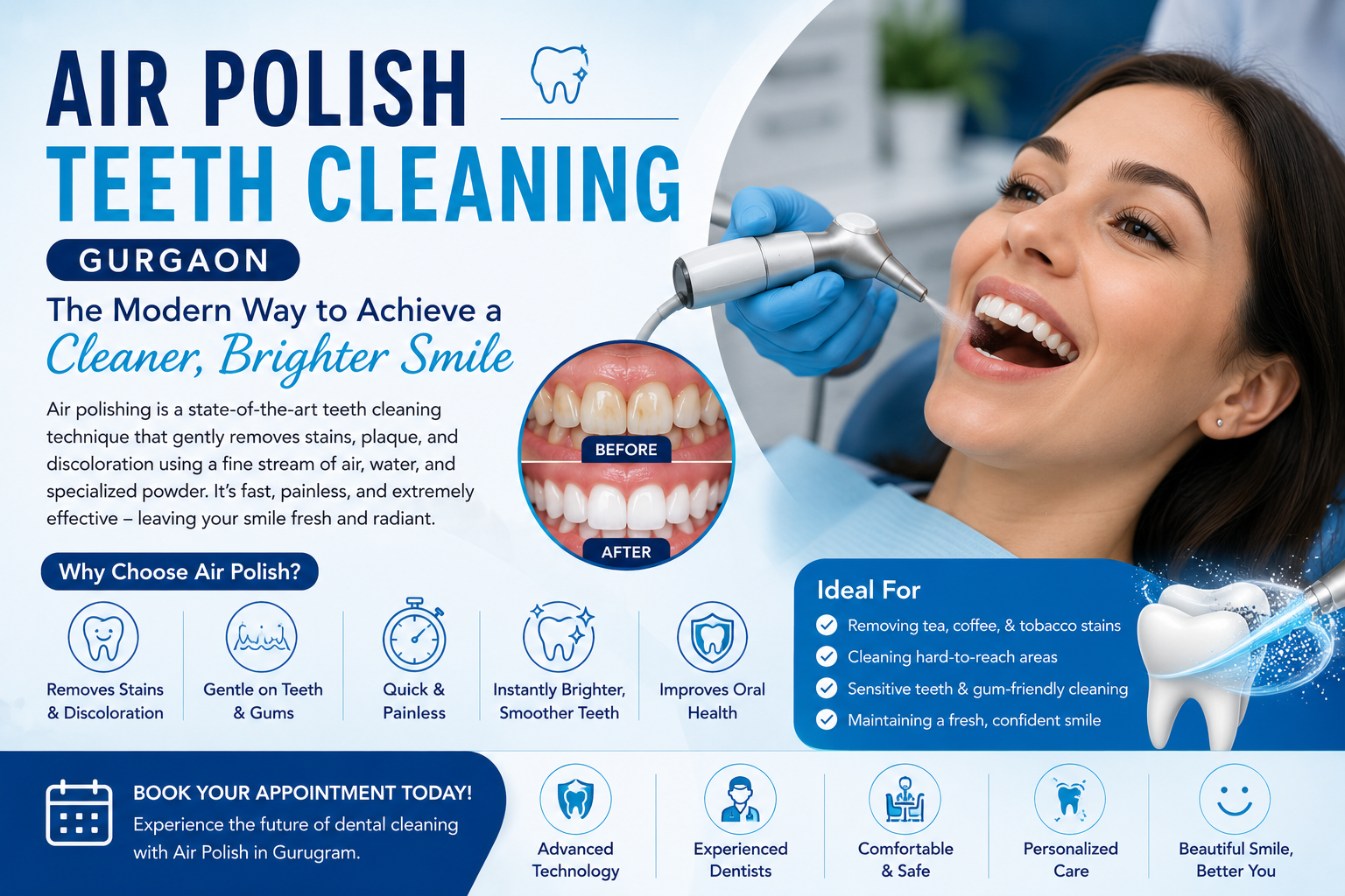 Air Polish Teeth Cleaning Gurgaon, Air Polishing Treatment Gurgaon, Advanced Dental Cleaning Gurgaon, Painless Teeth Cleaning Gurgaon, Dental Polishing Treatment Gurgaon, Professional Teeth Cleaning Gurgaon