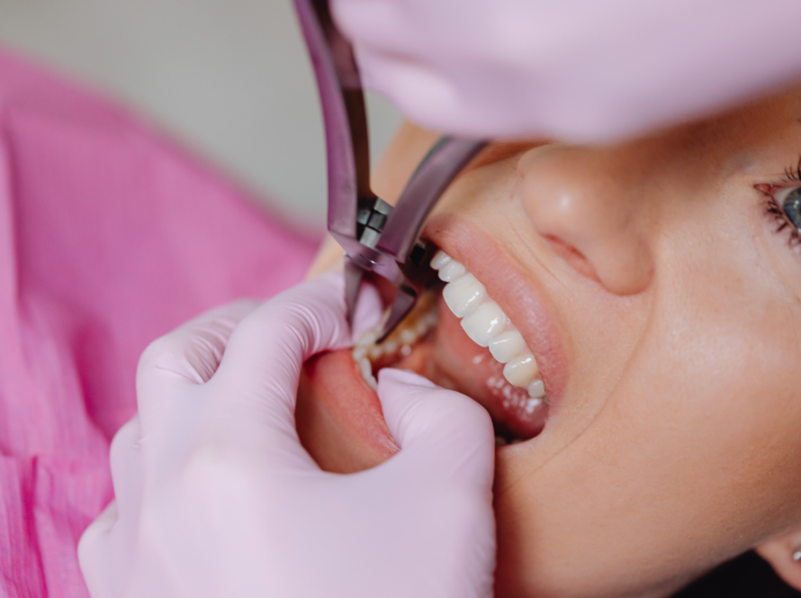 Dental Implants in Gurgaon A Reliable Solution for Missing Teeth