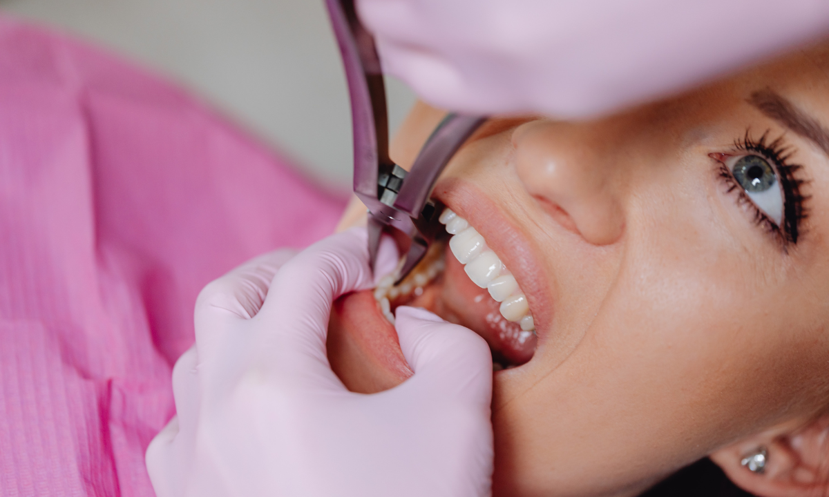 Dental Implants in Gurgaon A Reliable Solution for Missing Teeth