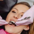 Painless Dental Implants in Gurgaon A Guide to Comfortable Tooth Replacement