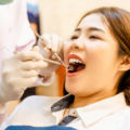 Best Dentist for Dental Implants Gurgaon: Complete Guide