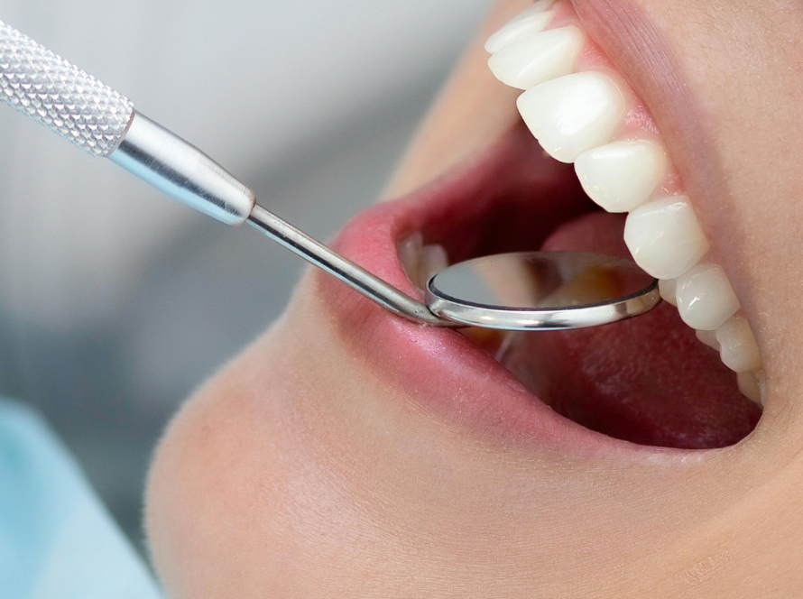 Dental Polishing Treatment Gurgaon