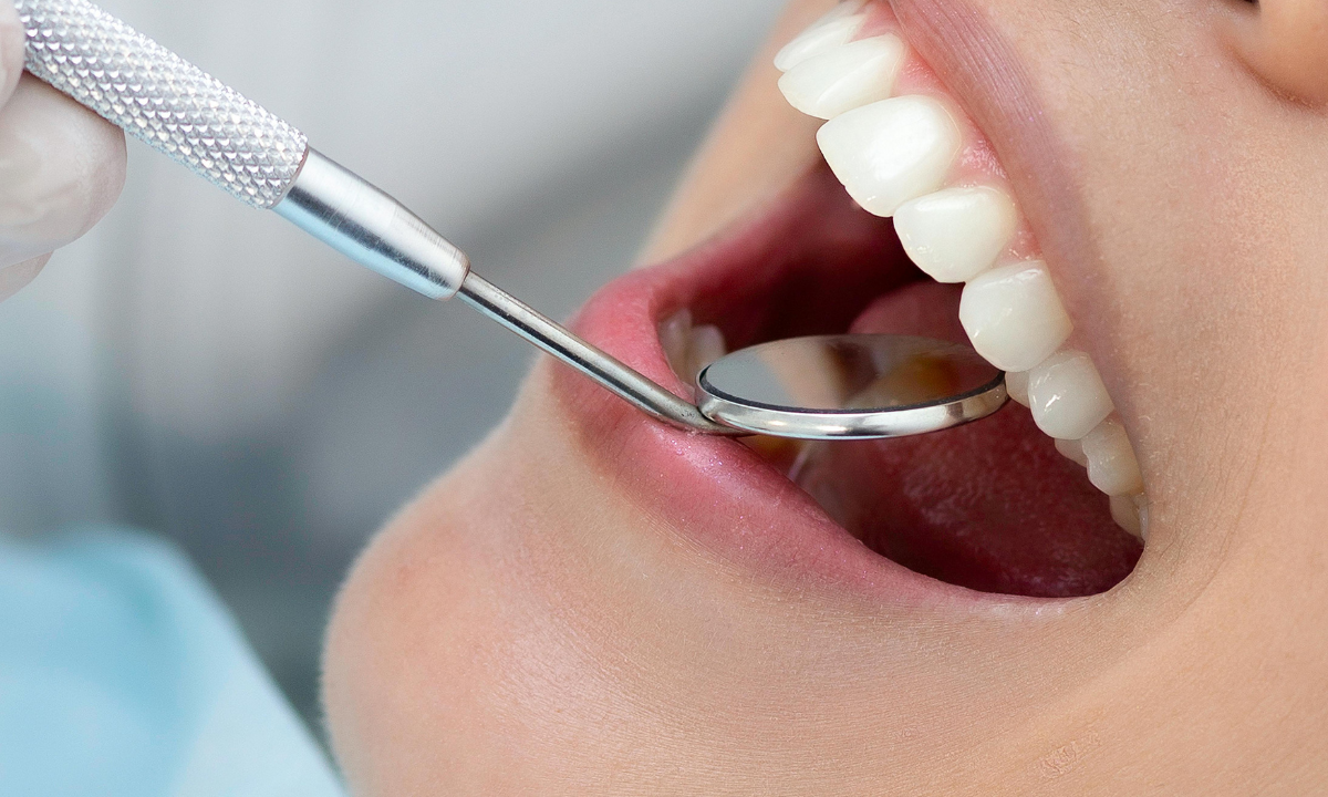 Dental Polishing Treatment Gurgaon