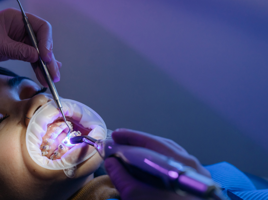 Root Canal Treatment in Gurgaon
