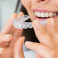 Best Invisalign Dentist Gurgaon: How to Choose the Right Expert for Your Smile