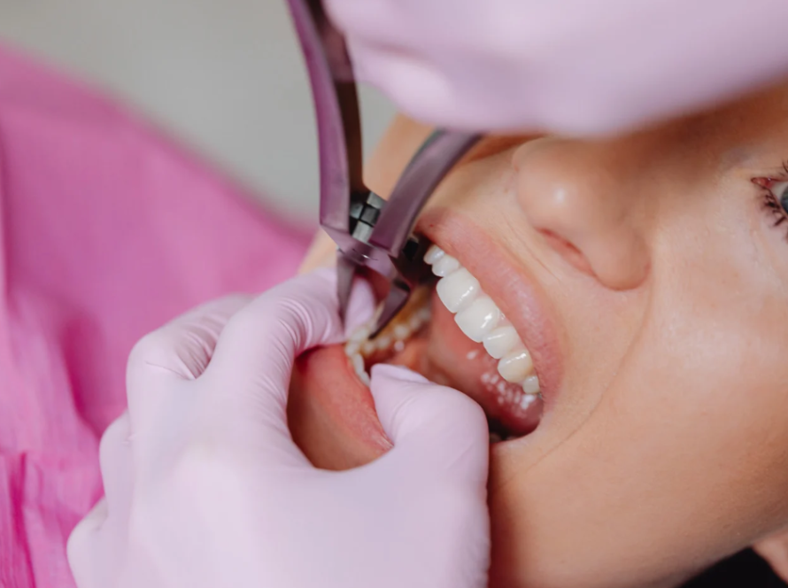 Root Canal Treatment in Gurgaon – A Guide to Saving Your Natural Tooth