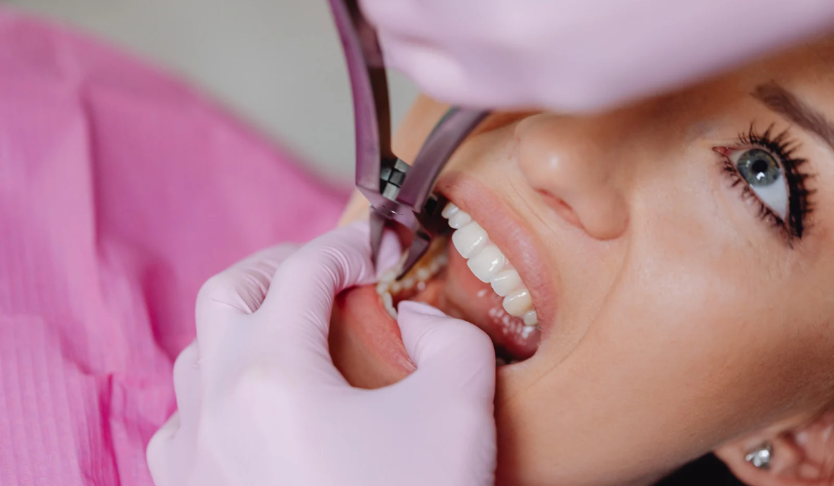 Root Canal Treatment in Gurgaon – A Guide to Saving Your Natural Tooth